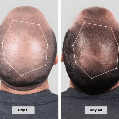 Red Light Cap for Hair Regrowth