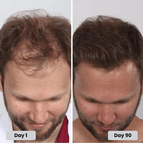 Red Light Cap for Hair Regrowth